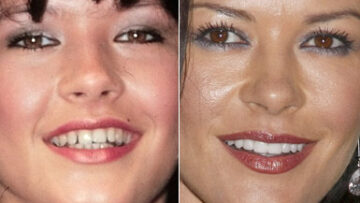 Catherine Zeta Jones denti