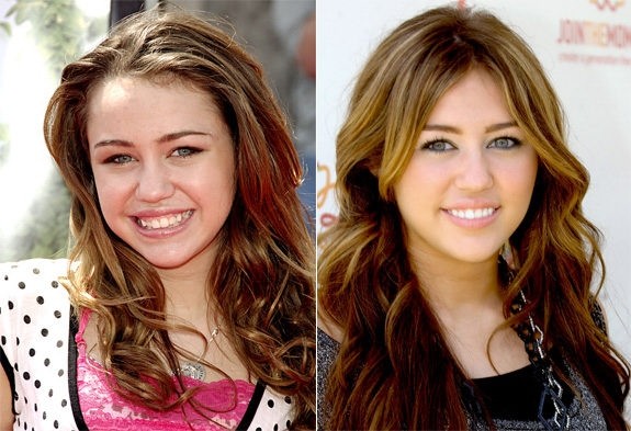 Miley Cyrus denti