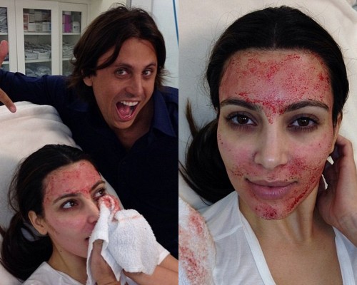 Kim Kardashian sangue viso