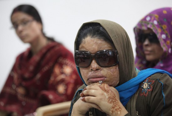 In India donne stuprate e sfigurate dall'acido02