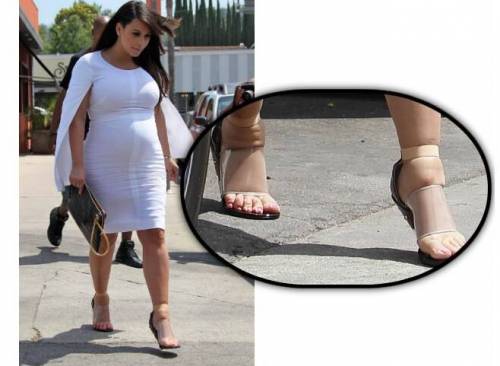 Kim Kardashian con piedi visibilmente gonfi stretti dentro delle scarpe con fascia in plastica