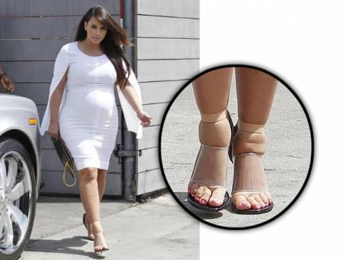 Kim Kardashian con piedi visibilmente gonfi stretti dentro delle scarpe con fascia in plastica