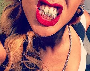 Rihanna, diamanti tra i denti: "Sono una stronza fuorilegge"