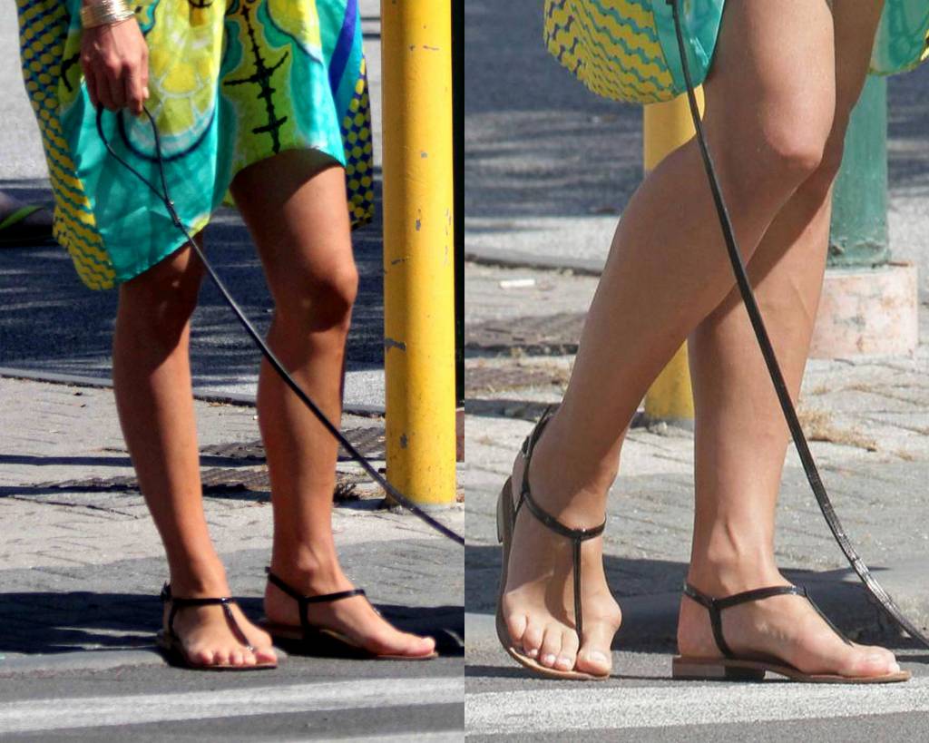 Michelle Hunziker ha l'alluce valgo. È 