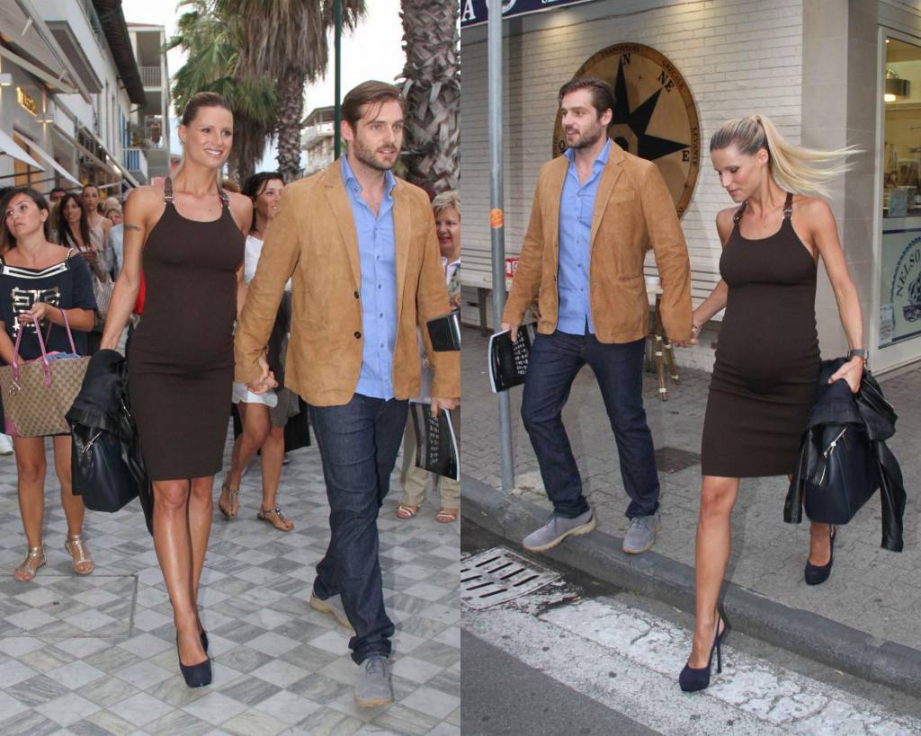 Michelle Hunziker ha l'alluce valgo. È 