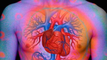 Psoriasi, chi soffre di forme gravi più esposto a malattie cardiache
