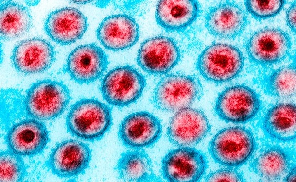 Bolzano: contagiato da Hiv chiede all'ex fidanzato 1 milione e 300mila euro