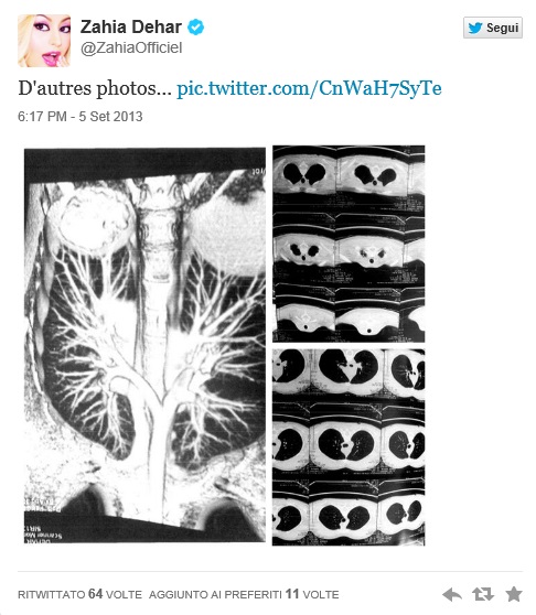 Zahia Dehar, (ex) baby escort: "Tette naturali", foto prove su Twitter