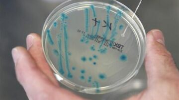 Scoperti 3 batteri resistenti agli antibiotici: allarme negli Usa