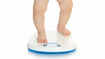 Bambini obesi? Da adulti raddoppia il rischio di ipertensione