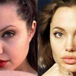 Angelina_Jolie_prima_e_dopo_chirugia_estetica