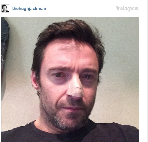 Hugh_Jackman_1 Hugh_Jackman_1
