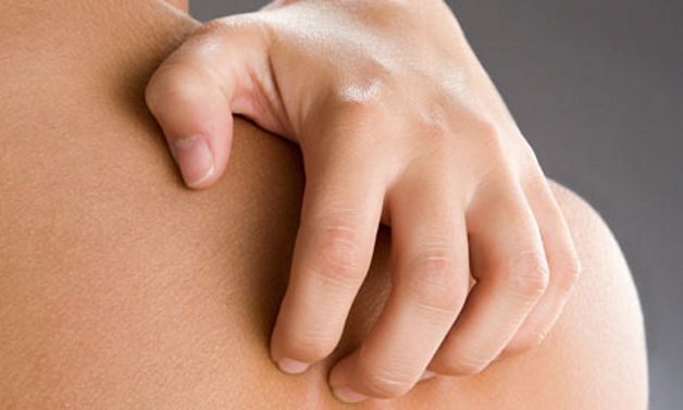 Orticaria: rossori e gonfiori per 1 su 5. Colpa di farmaci e cibi