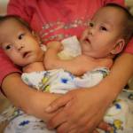 Cina gemelli siamesi abbandonati in un orfanotrofio 02