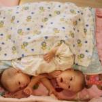 Cina gemelli siamesi abbandonati in un orfanotrofio 03