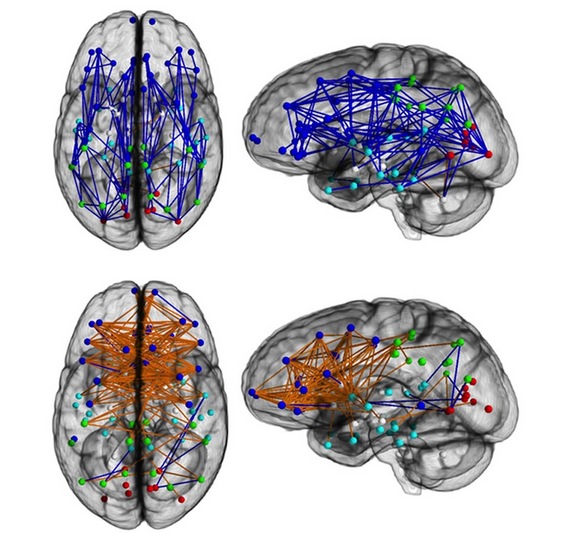 Uomini e donne, perché pensieri così diversi? La risposta nel cervello...