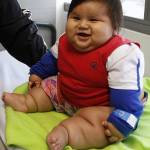 Santiago, il bimbo colombiano che a 8 mesi pesa 20 chili01