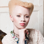 Thando Hopa, la modella albina che posa contro le discriminazioni06