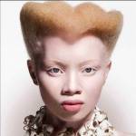 Thando Hopa, la modella albina che posa contro le discriminazioni01