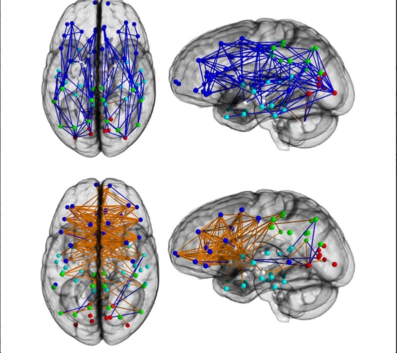 Cervello delle donne: in cosa si differenzia da quello degli uomini