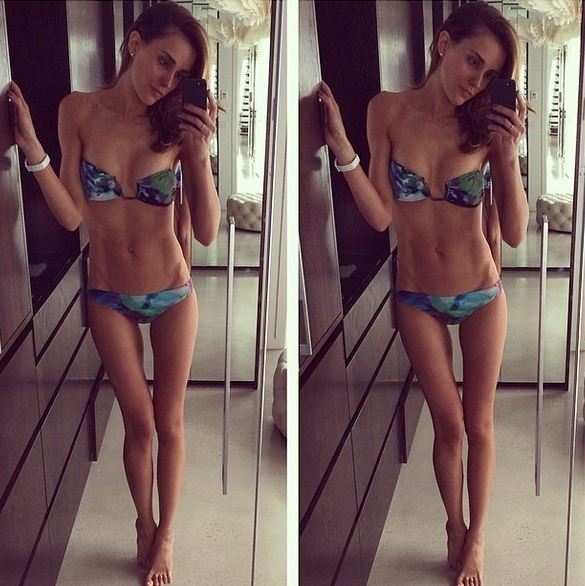 Anoressia, modella australiana sotto accusa: scheletrica o “solo” in forma?