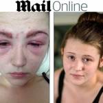 Katie, 16 anni, rischia di rimanere cieca per una tintura alle sopracciglia