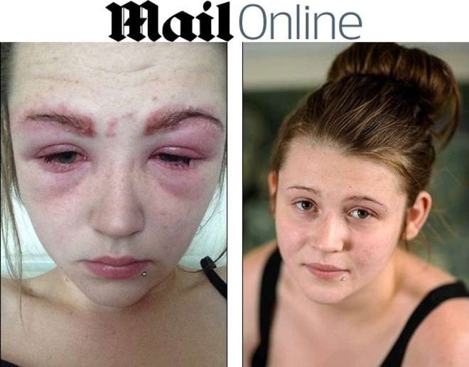 Katie, 16 anni, rischia di rimanere cieca per una tintura alle sopracciglia