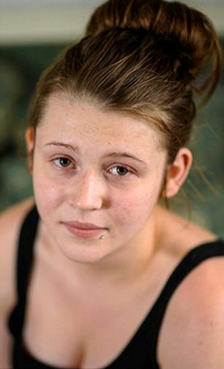 Katie, 16 anni, rischia di rimanere cieca per una tintura alle sopracciglia