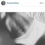Smagliature, cellulite... da Instagram all'arte si celebra la donna vera