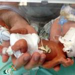 Lucas compie 1 anno: nato prematuro, medici lo davano per spacciato