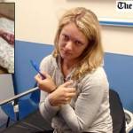 Le sanguina sempre il naso: nella narice ha una sanguisuga lunga 8 centimetri02