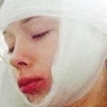 Valeria Lukyanova, la Barbie umana, aggredita e picchiata (FOTO)