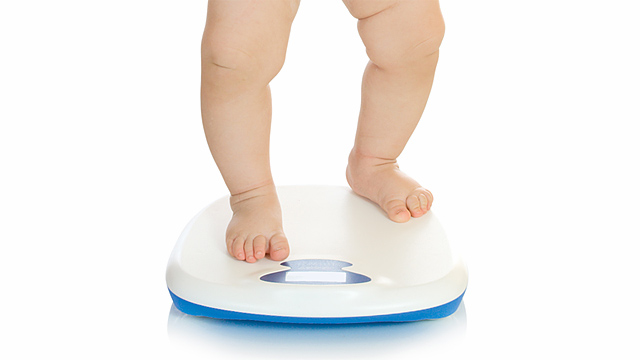 Bambini sovrappeso, vista a rischio. Obesità minaccia la retina