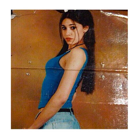 Belen Rodriguez prima e dopo la chirurgia FOTO