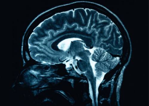 Risonanza al cervello per predire comportamenti e disturbi