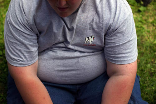 Obesità come il cancro: vita si accorcia di 10 anni