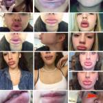 #KylieJennerLipsChallenge, labbra gonfie senza iniezioni: nuova pericolosa moda