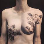 Tumore al seno: quando un tatuaggio nasconde le cicatrici e restituisce sorriso 1