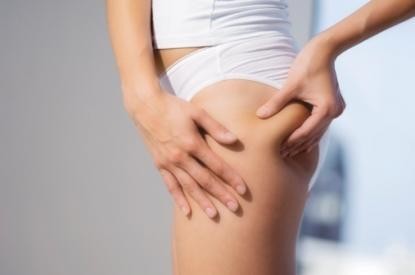 Cellulite, come sconfiggerla: sport, alimentazione e creme. Ecco quali