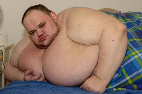 Carl Thompson, 412 chili: morto l'uomo più grasso d'Inghilterra