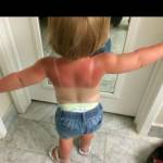Crema solare di Jessica Alba sotto accusa: "Bimbi ustionati, non protegge"