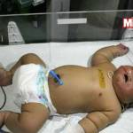India, neonato record da 6,5 chilogrammi
