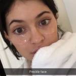 Kylie Jenner cancella le borse sotto gli occhi4