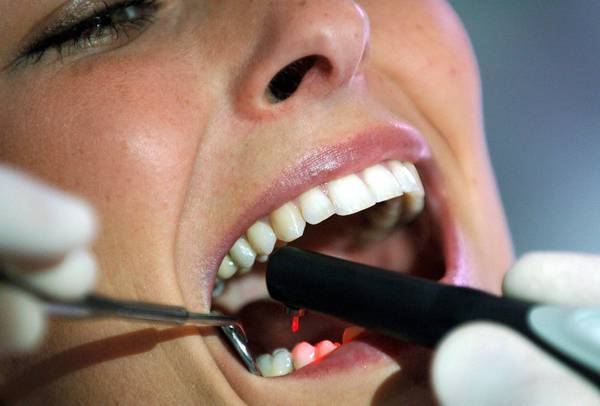 Carie addio: arriva dente antibatterico stampato in 3D
