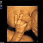 Il feto che saluta la mamma con due dita5