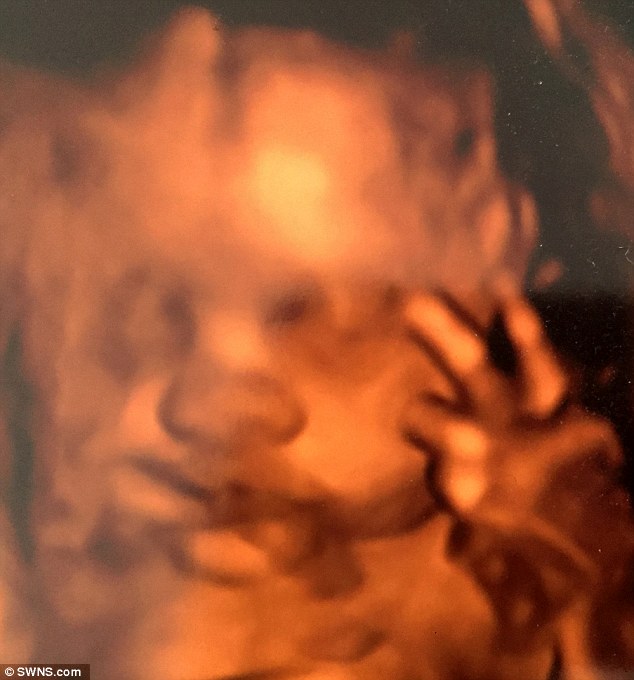 Il feto che saluta la mamma con due dita2