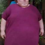 Perde 115 kg col bypass gastrico, poi abusa antidolorifici e rischia morte