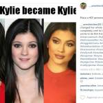 Kylie Jenner prima e dopo: chirurgia plastica? FOTO e VIDEO