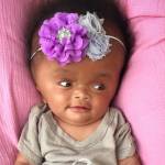 Haiti, neonata con malformazione adottata2