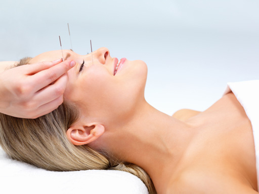 Menopausa, agopuntura riduce vampate di calore e sudorazioni